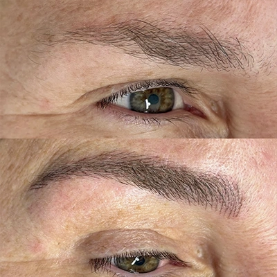Antes - Cejas