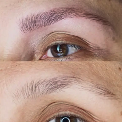 Después - Tratamiento de Cejas